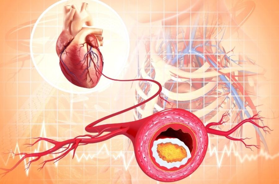 early warning signs of atherosclerosis