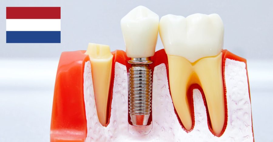 tandheelkundige implantaten